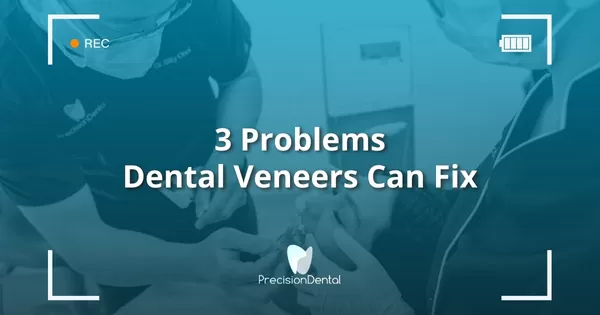 3 Problems Dental Veneers Can Fix
