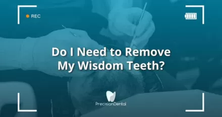 Do I Need to Remove My Wisdom Teeth?