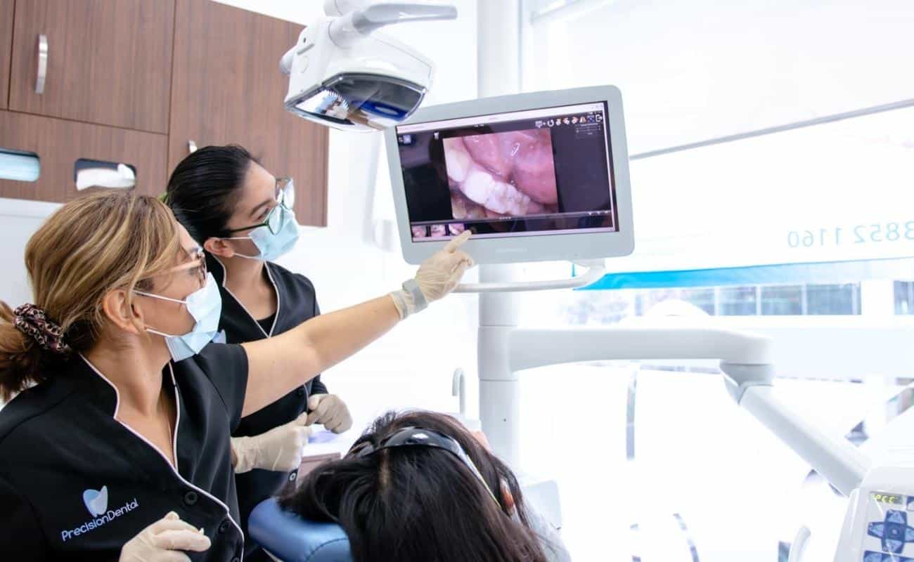 Tooth Fillings Brisbane, Fortitude Valley - Precision Dental